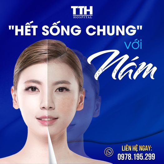 Hết sống chung với nám sau khi điều trị nám tại bệnh viện Thái Thượng Hoàng