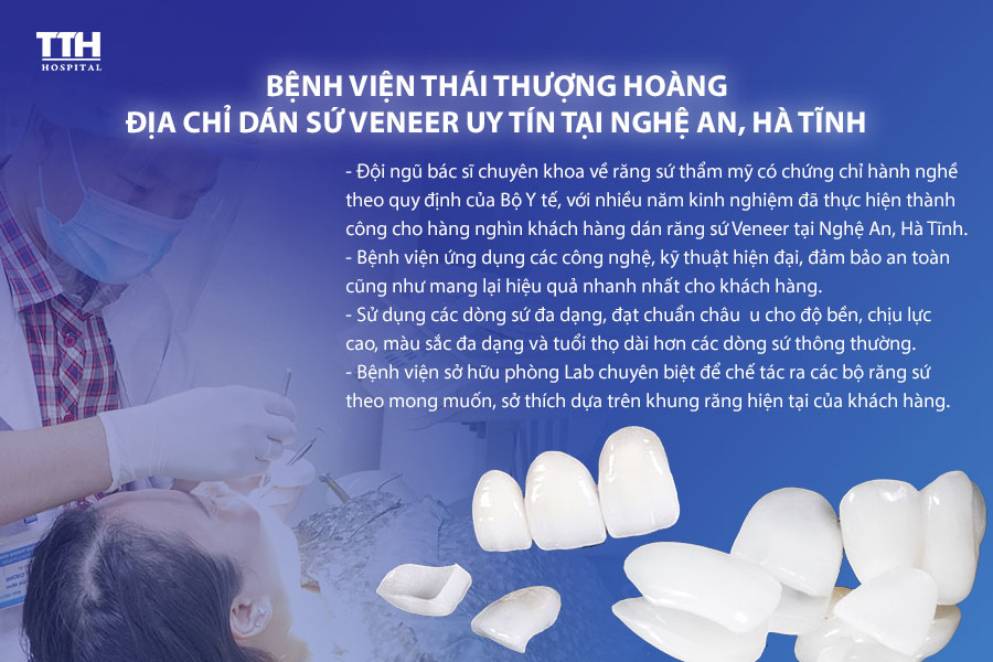 5 ƯU ĐIỂM VƯỢT TRỘI CỦA MẶT DÁN SỨ VENEER