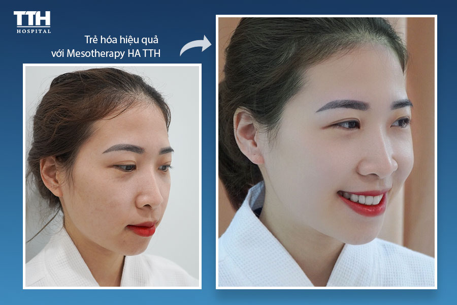 NGĂN NGỪA LÃO HÓA DA