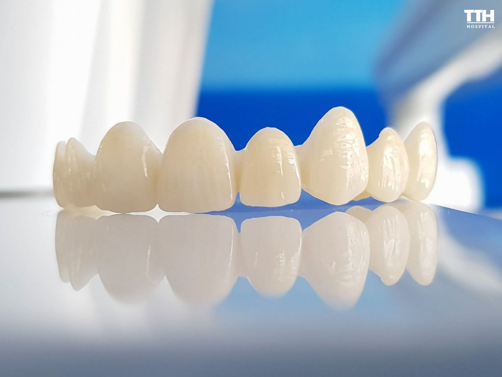 Răng toàn sứ Lisi là một trong những dòng răng sứ thẩm mỹ cao cấp được ưa chuộng nhất hiện nay