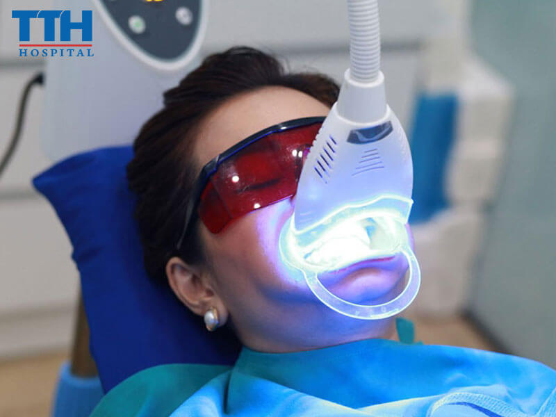 Địa chỉ tẩy trắng răng hiệu quả tại Nghệ An