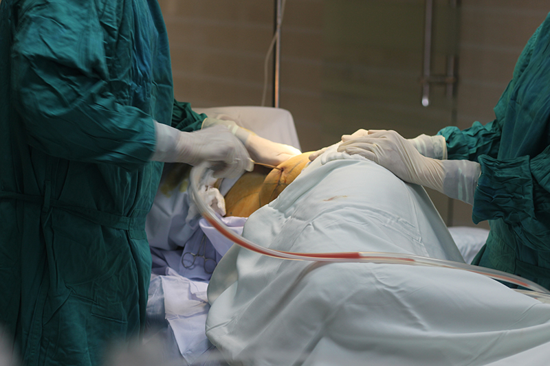ưu điểm của hút mỡ body jet