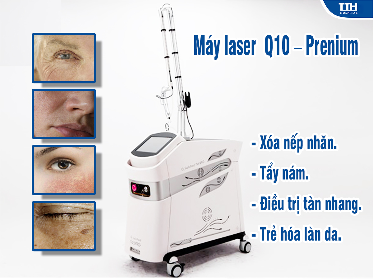 Máy laser Q10 – Prenium