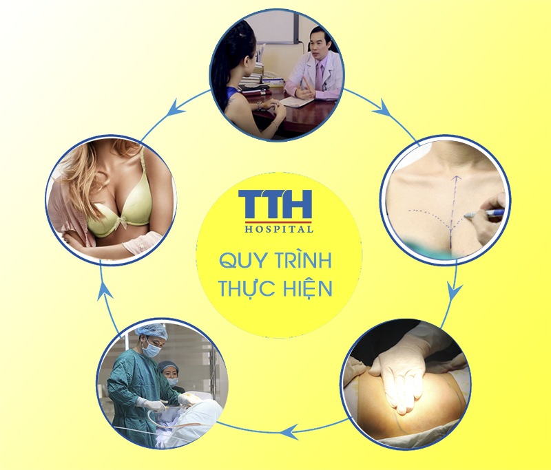 quy trình thực hiện hút mỡ bodyjet