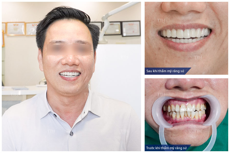 Nếu bạn vẫn còn những băn khoăn, đừng ngại chia sẻ với Bệnh viện Thái Thượng Hoàng