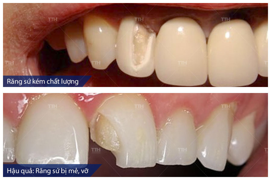TIÊU CHÍ LỰA CHỌN ĐỊA CHỈ THẨM MỸ RĂNG SỨ UY TÍN