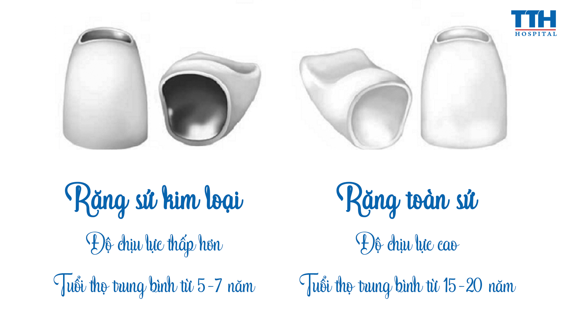 Độ bền và tuổi thọ của hai loại răng này là khác nhau