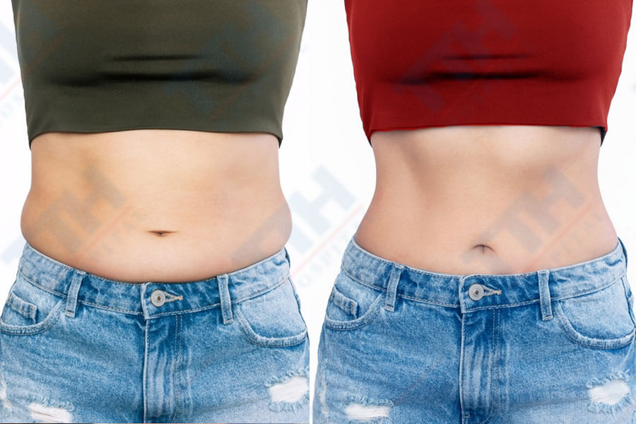 Ưu điểm vượt trội của công nghệ Body Jet