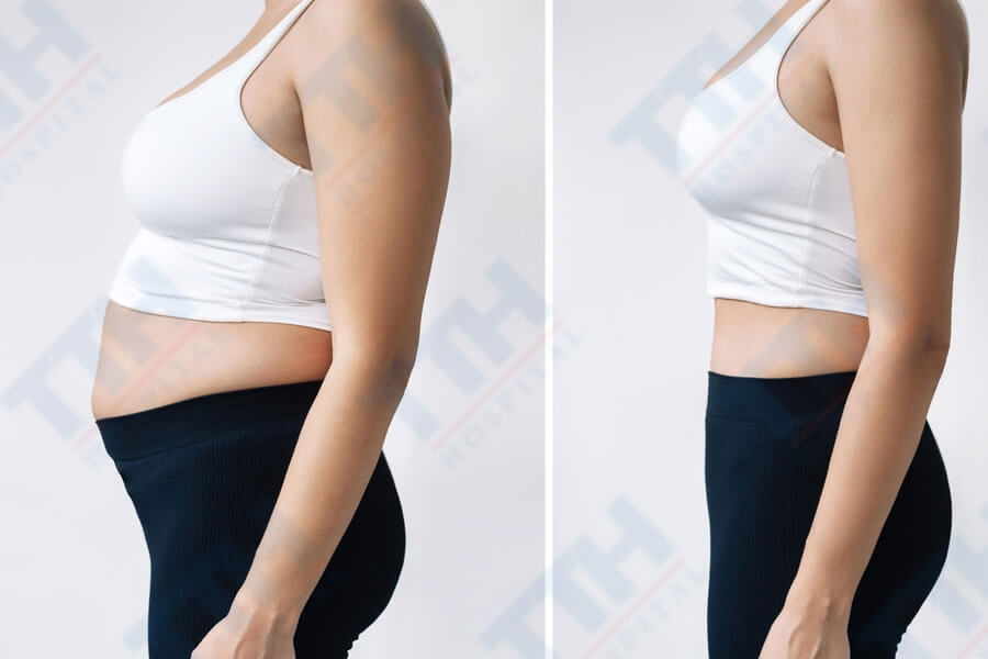 Body Jet giúp định hình đường cong cơ thể một cách hài hòa