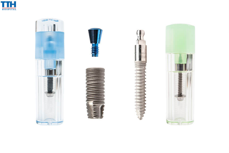 Các yếu tố ảnh hưởng đến chi phí trồng răng implant