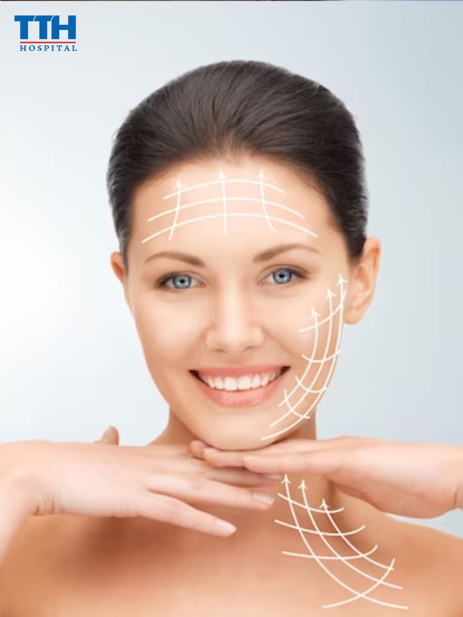 Cách chăm sóc sau khi thực hiện Căng chỉ sinh học tại Vinh, Nghệ An