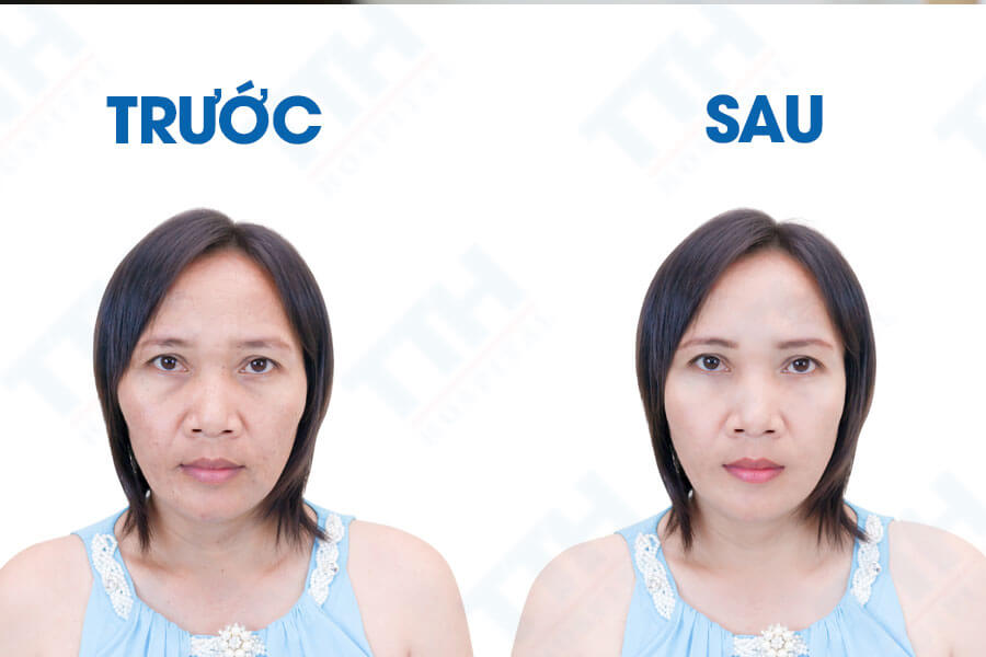 Cách Exosome được ứng dụng trong chăm sóc da