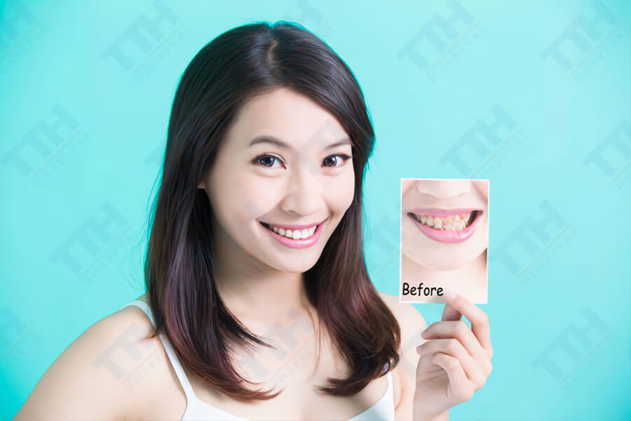 Cải Tạo Nụ Cười Bằng Cách Điều Trị Răng Hàm Mặt