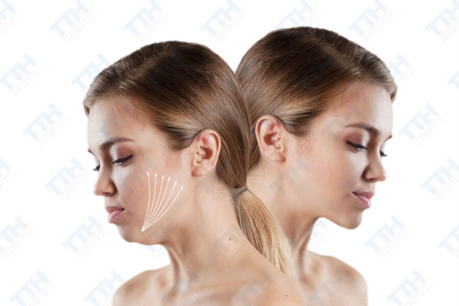 Cải thiện thẩm mỹ khuôn mặt