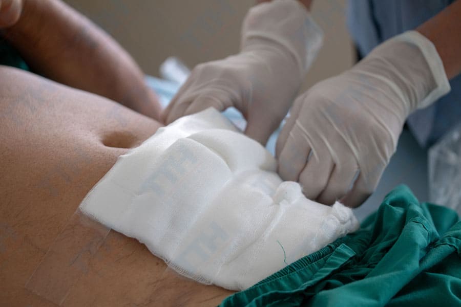 Cần Lưu Ý Gì Sau Phẫu Thuật Tạo Hình Bụng Sáu Múi?