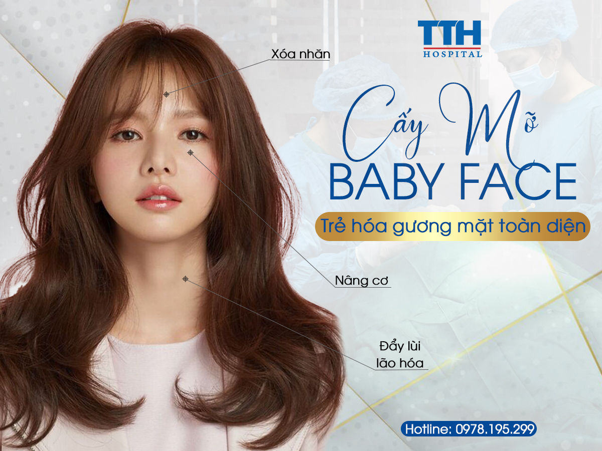 cấy mỡ baby face