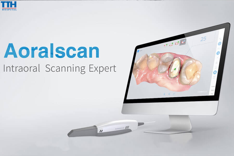 Công Nghệ Scan Răng AORAL 3D SCANNING