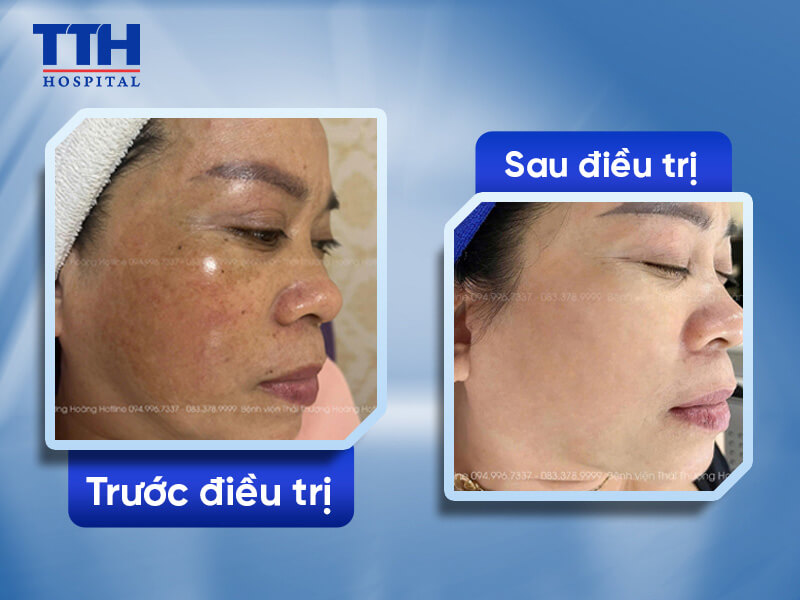 KHÁCH HÀNG NÓI GÌ VỀ CHÚNG TÔI?