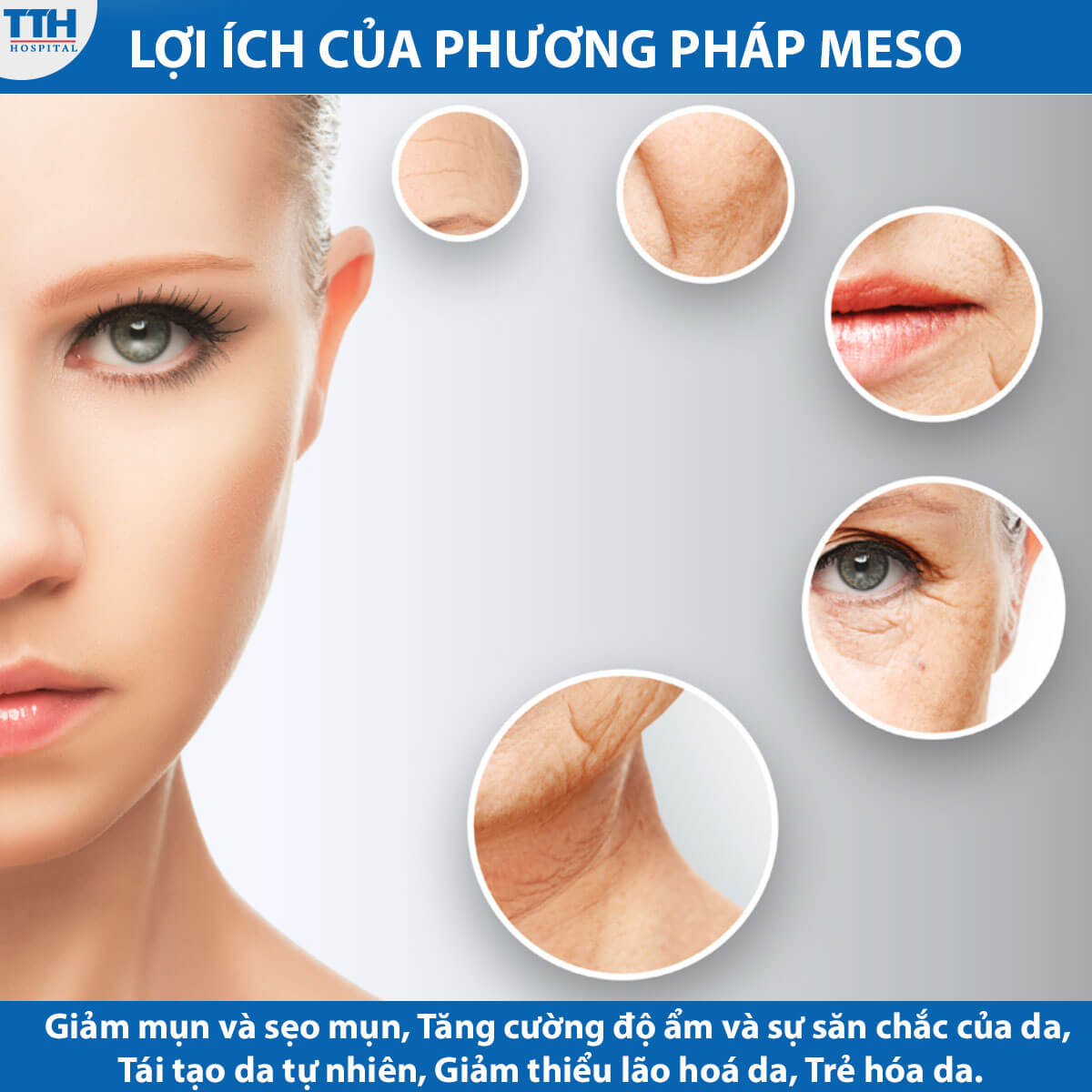 Lợi ích của trẻ hóa da meso