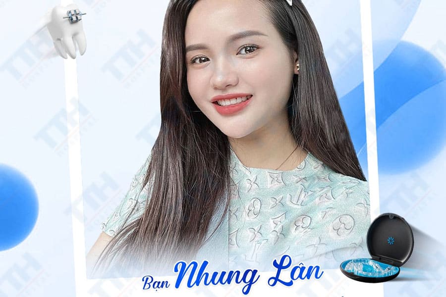Lợi Ích Khi Niềng Răng Đúng Cách