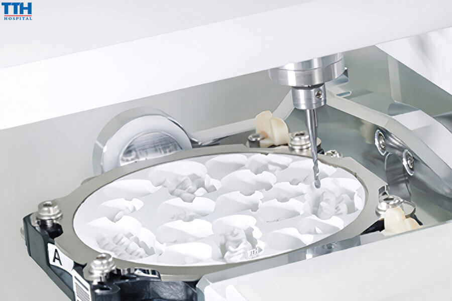 Lợi Ích Khi Sử Dụng Công Nghệ CAD/CAM 3D Roland DWX-52D Tại Bệnh Viện Thái Thượng Hoàng