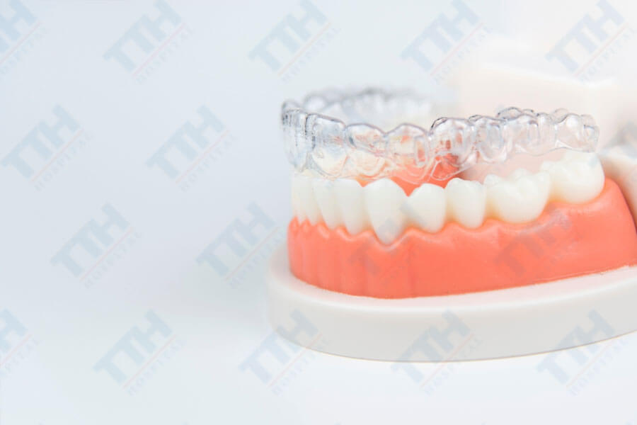 TTH Aligners đã và đang trở thành một trong những lựa chọn hàng đầu cho những ai muốn cải thiện nụ cười của mình.