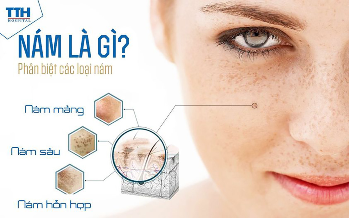 Nám da là gì?