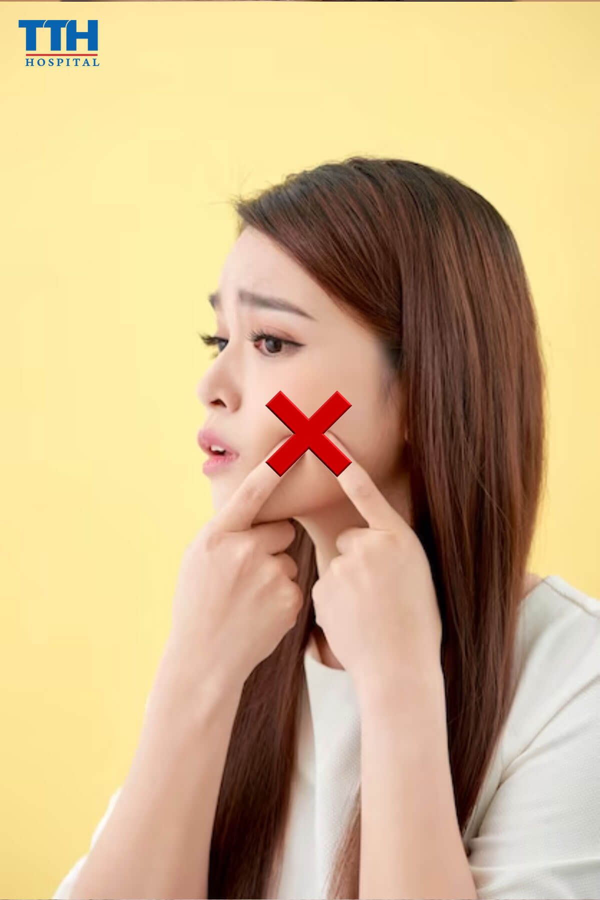 nặn mụn làm tổn thương da, gây ra viêm nhiễm, nhiễm trùng và sẹo da tại Vinh, nghệ an
