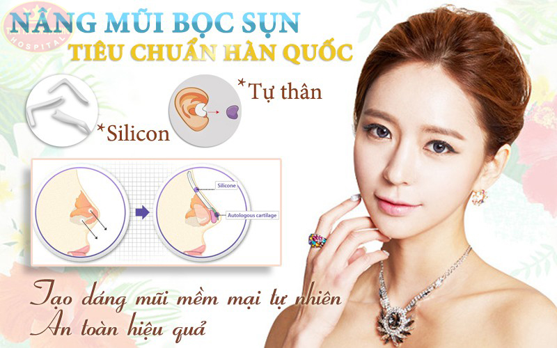 Nâng mũi bọc sụn tiêu chuẩn hàn quốc