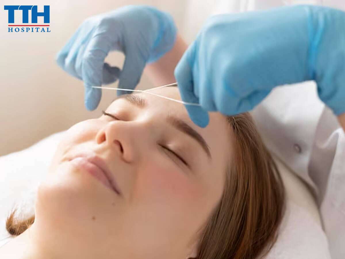 Nâng mũi chỉ là gì - Nâng mũi chỉ tại Vinh Nghệ An