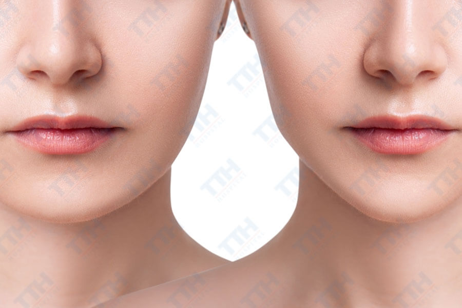 Người cần cải thiện thẩm mỹ khuôn mặt