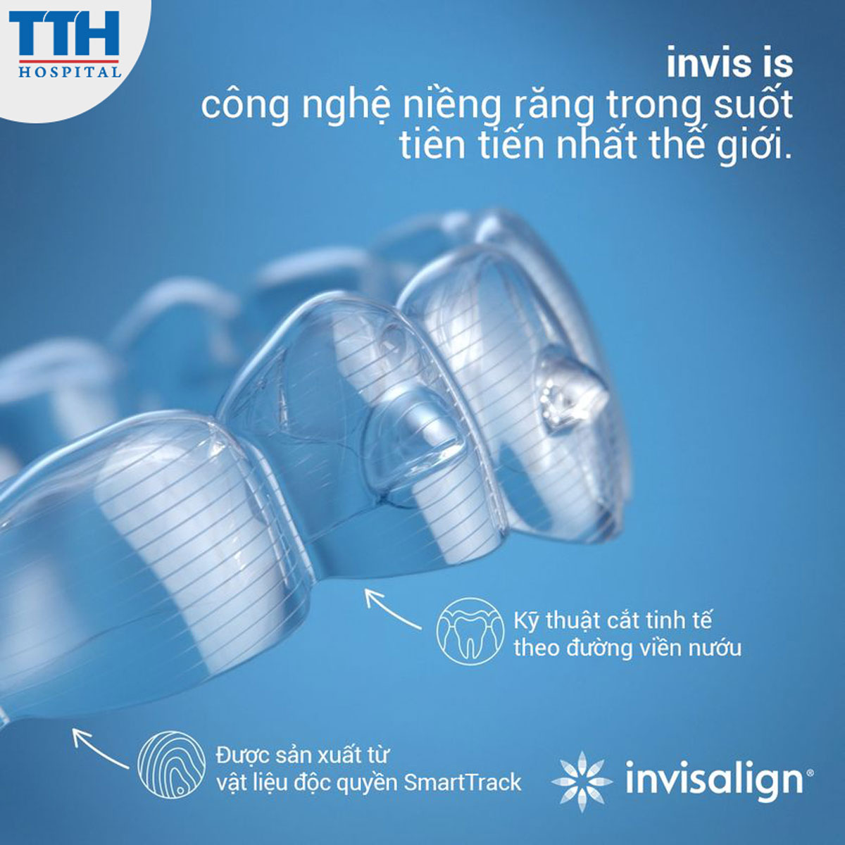 Ưu điểm của niềng răng trong suốt