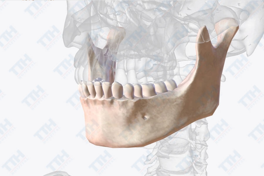 Phần mềm mô phỏng và lập kế hoạch phẫu thuật hàm mặt
