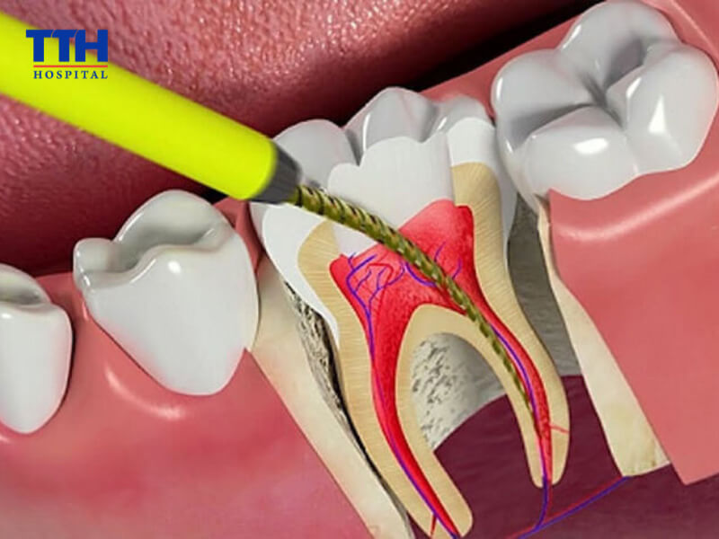 Phát hiện sớm và điều trị kịp thời sẽ mang lại hiệu quả tốt