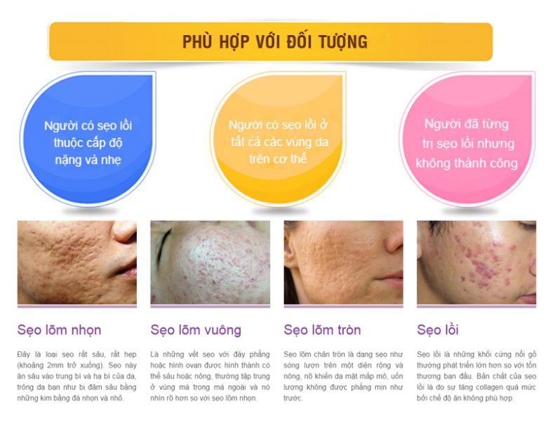 Các loại Sẹo