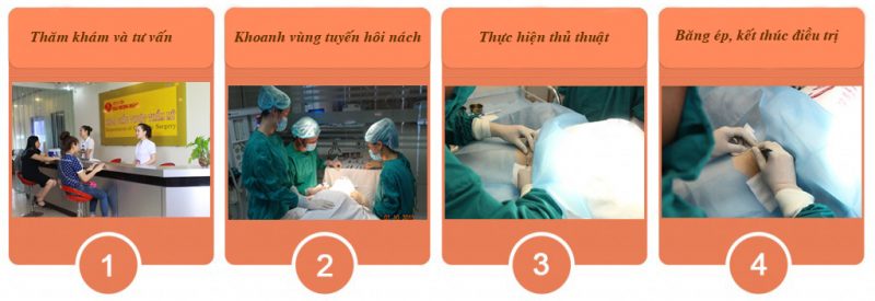 Băng ép kết thúc việc điều trị