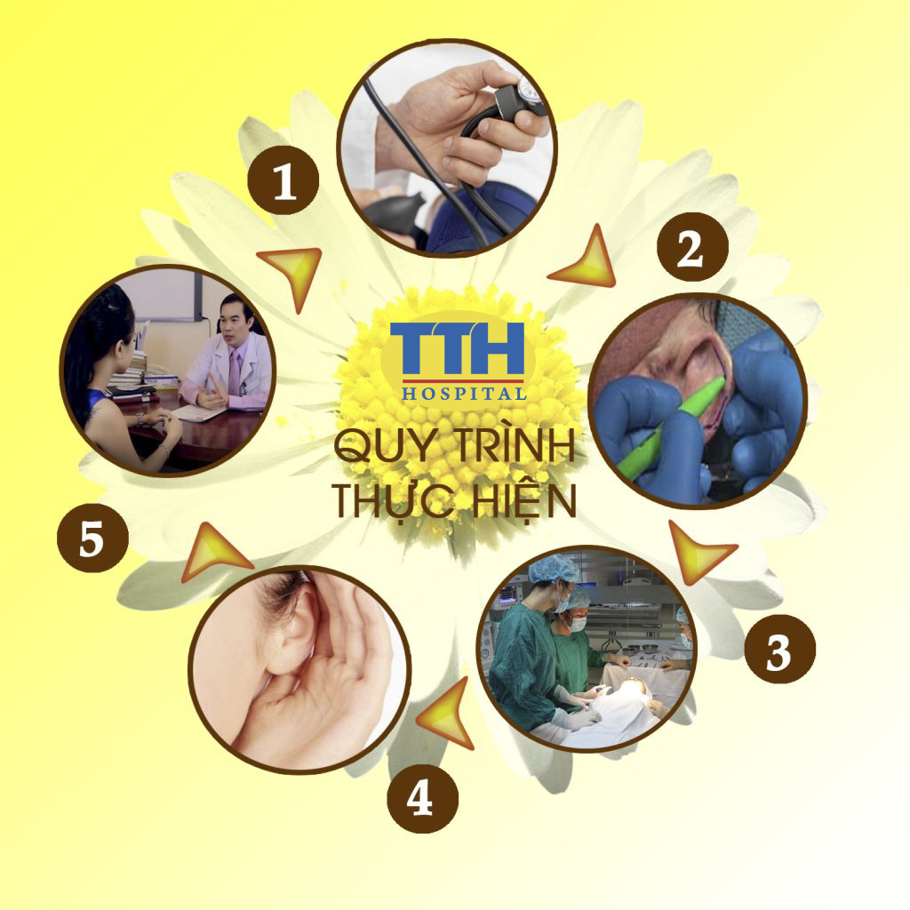 Quy trình thực hiện Phẫu thuật tạo hình vành tai