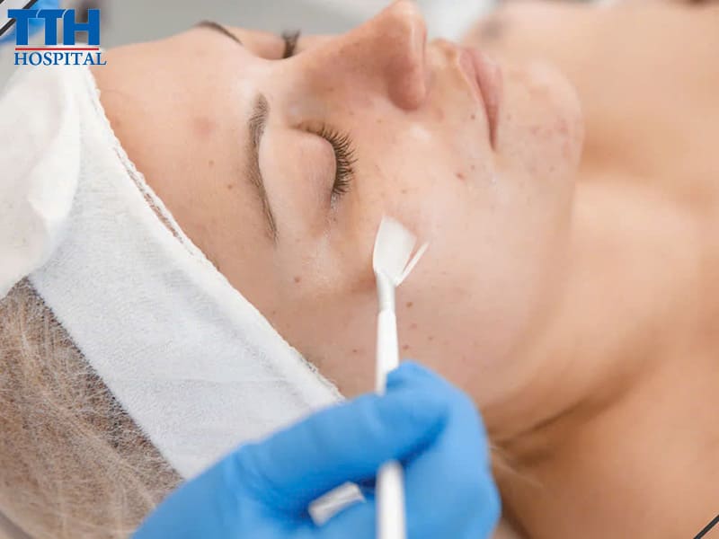 Hướng Dẫn Chăm Sóc Da Sau Khi Tia Nhẹ