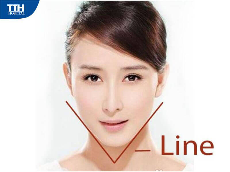 Tái cấu trúc gương mặt V-line là gì? 