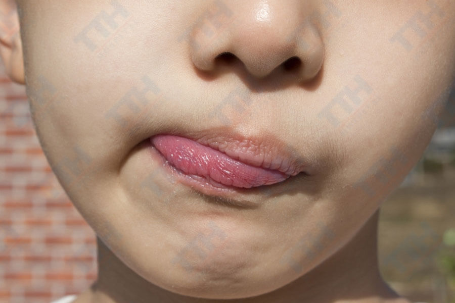 Độ tuổi vàng để phẫu thuật hàm mặt
