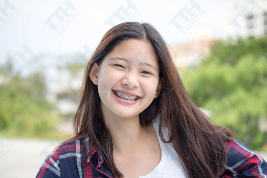 Thời Điểm Lý Tưởng để Niềng Răng Cho Trẻ Em