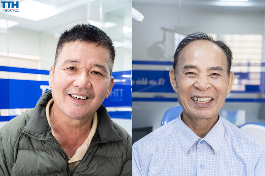 Trồng răng implant - Giải pháp cho hệ tiêu hóa khỏe mạnh