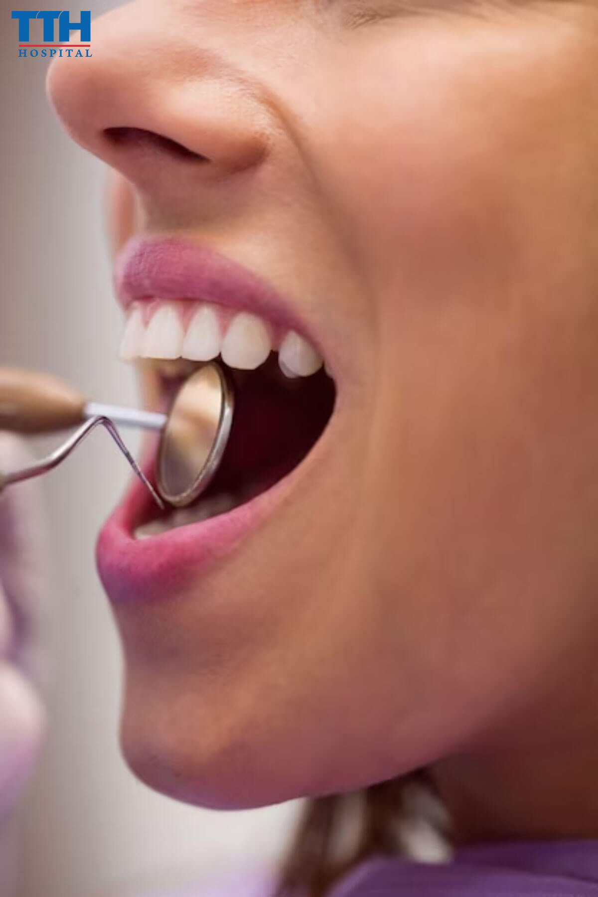 Ưu Điểm của Bọc Răng Sứ tại Vinh Nghệ An