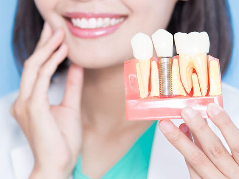 Ưu điểm vượt trội của trồng răng Implant