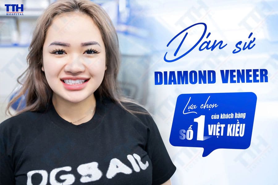 Việt Kiều Về Nước Làm Răng Sứ Ở Đâu? Lựa Chọn Hàng Đầu – Bệnh Viện Thái Thượng Hoàng