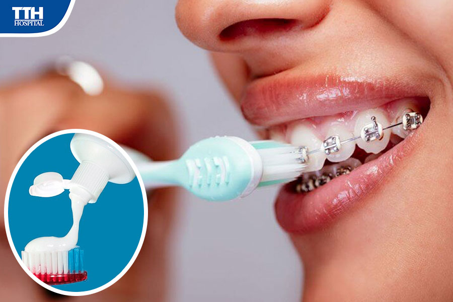 CÔNG CỤ CHĂM SÓC RĂNG NIỀNG HIỆU QUẢ