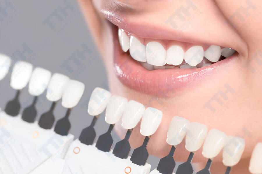 yếu tố quan trọng nhất của nụ cười chuẩn Mỹ là màu sắc của răng