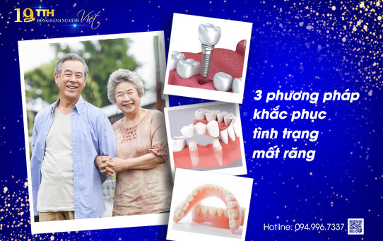 3 phương pháp khắc phục tình trạng mất răng