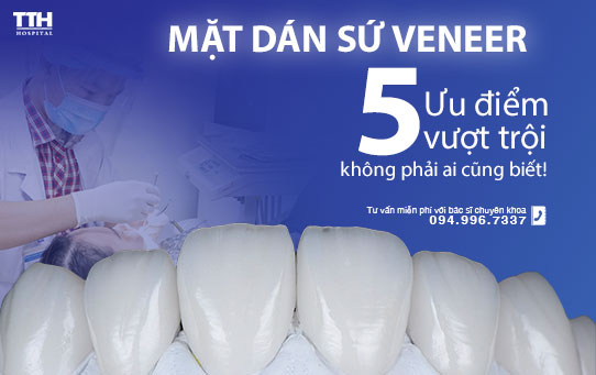 Mặt dán sứ Veneer và 5 ưu điểm vượt trội không phải ai cũng biết