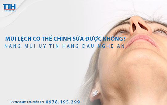 Mũi lệch có thể chỉnh sửa được không? Nâng mũi uy tín hàng đầu Nghệ An, Hà Tĩnh tại Bệnh viện Thái Thượng Hoàng